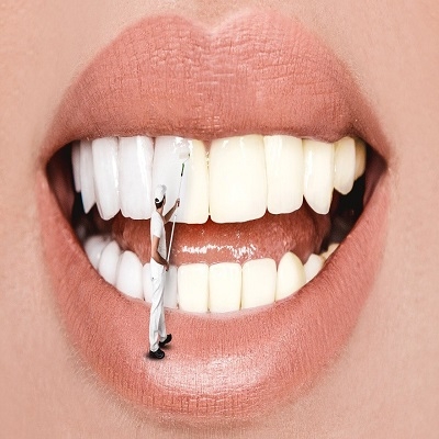 7 Hábitos que prejudicam os dentes; além da falta de higiene
