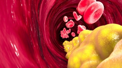 Cinco superalimentos que reduzem os nÃ­veis de colesterol