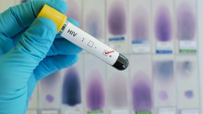 HIV: OMS recomenda uso de remédio injetável para previr infecção pelo vírus
