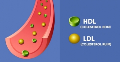 Conheça as diferenças entre o Colesterol Bom e Ruim